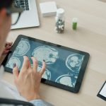 Profissional de saúde analisa imagens do cérebro em um tablet em ambiente clínico.