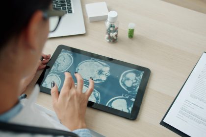 Profissional de saúde analisa imagens do cérebro em um tablet em ambiente clínico.