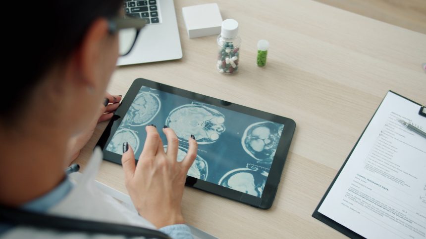 Profissional de saúde analisa imagens do cérebro em um tablet em ambiente clínico.